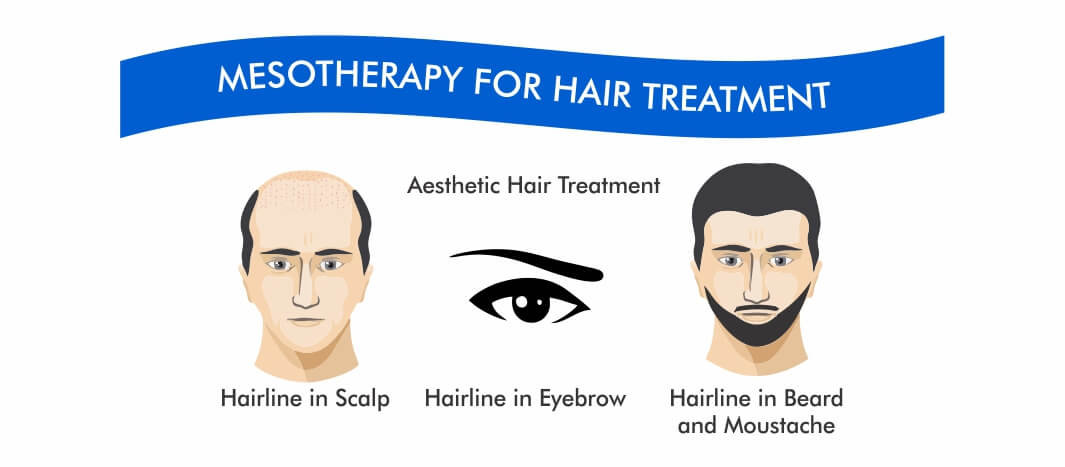 Regain Hair Clinic Mesotherapy Regain Hair Clinic Mesotherapy
