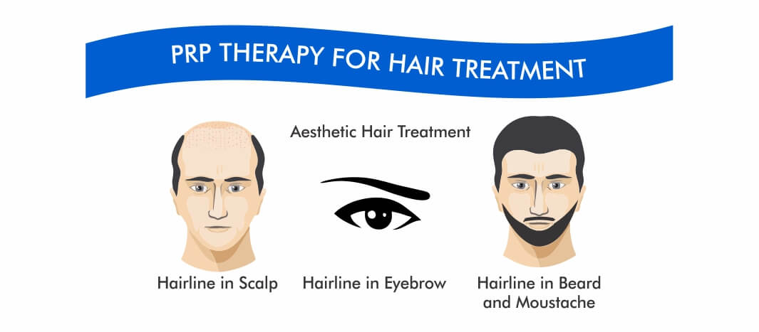 Regain Hair Clinic PRP Regain Hair Clinic PRP